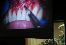 Proyectores audiovisuales Christie Mirage, 3D en directo de Europa en la primera cirugía odontológica Proyectores audiovisuales Christie Mirage, 3D en directo de Europa
